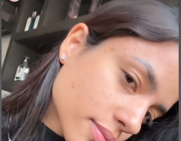Depois do tratamento — pele com aspecto uniforme